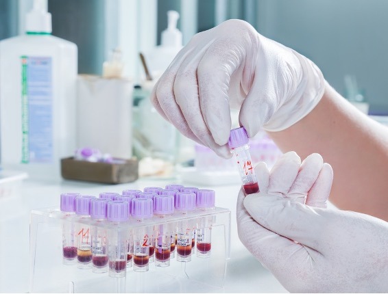 Blood Samples